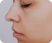 تصویر قبل از درمان