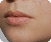 تصویر قبل از درمان