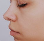 تصویر بعد از درمان